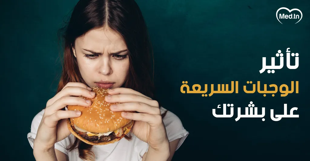تأثير الوجبات السريعة على بشرتك